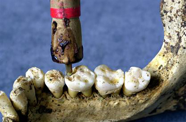 El misterio del rechinar de dientes en la boca